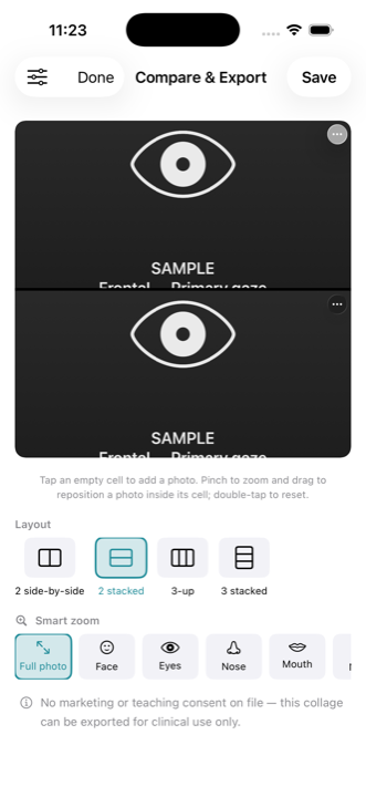 Before-and-after comparison and collage builder in SurgiMD